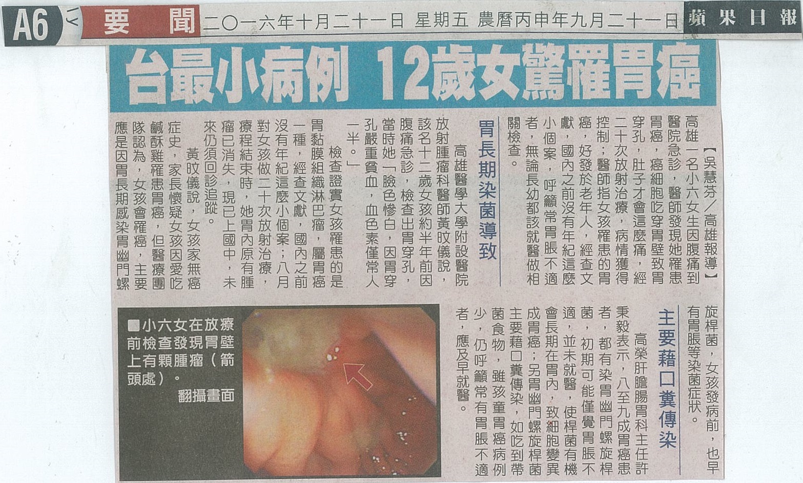 1051021台最小病例 12歲女驚罹胃癌蘋果日報